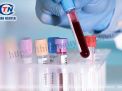 Các phương pháp xét nghiệm vi khuẩn HP phổ biến nhất hiện nay